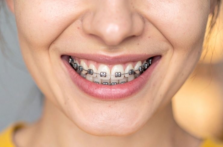 Sri SV Dental