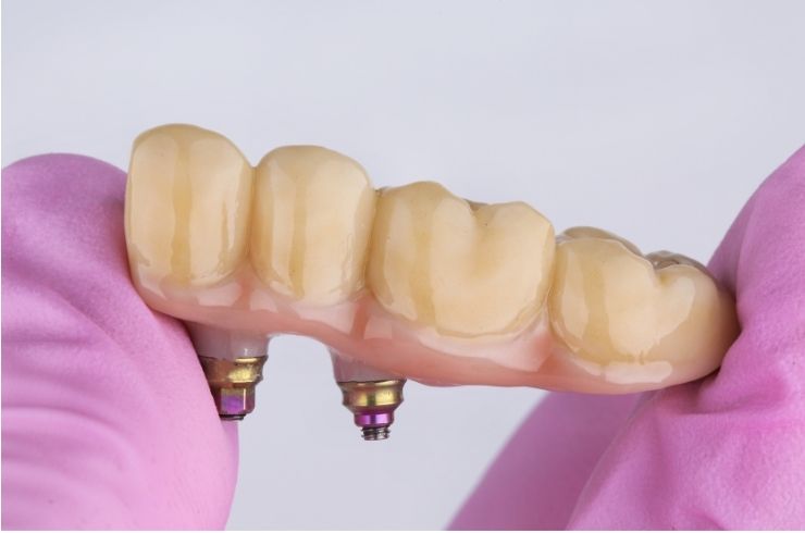 Sri SV Dental