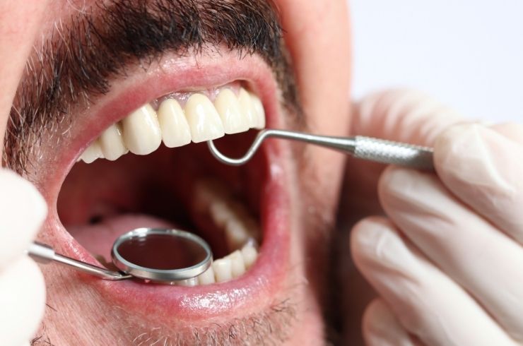 Sri SV Dental