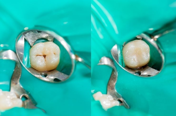 Sri SV Dental
