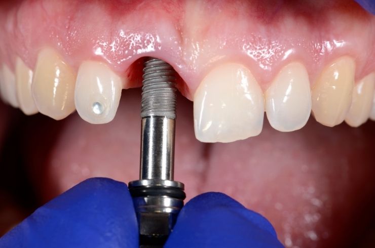 Sri SV Dental