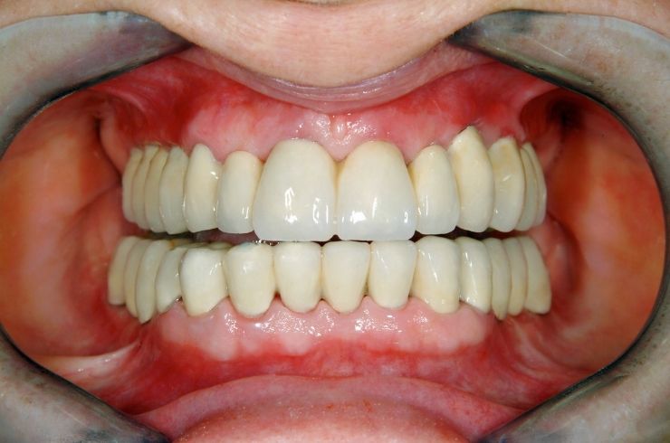 Sri SV Dental
