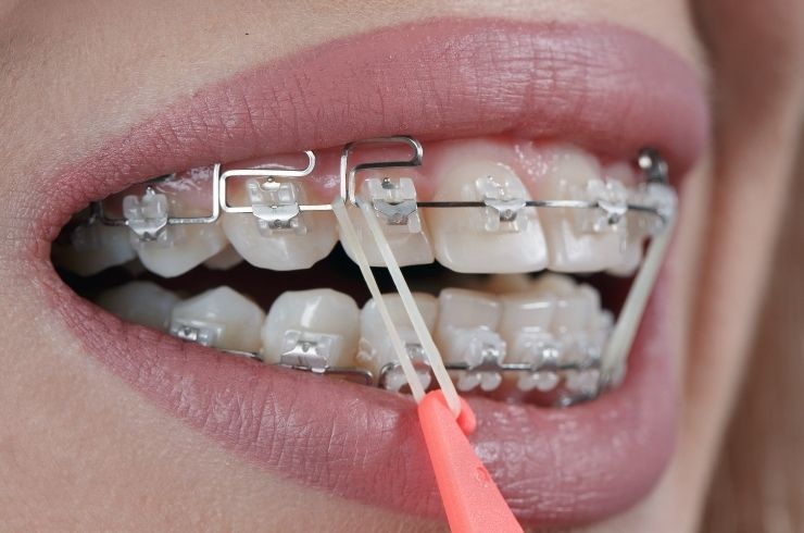 Sri SV Dental