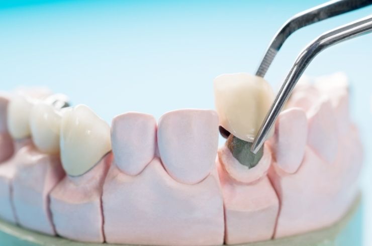 Sri SV Dental