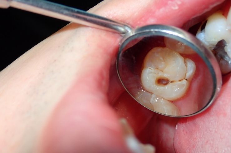 Sri SV Dental