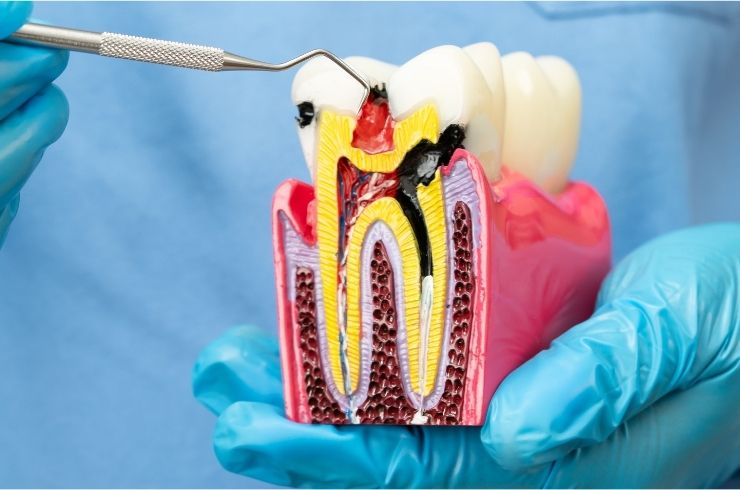 Sri SV Dental