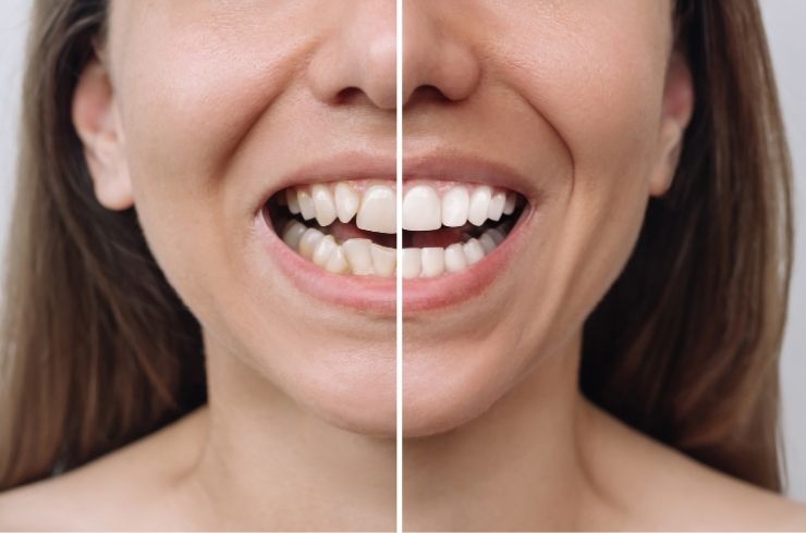 Sri SV Dental