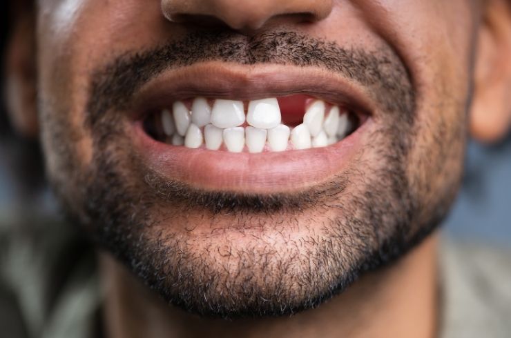 Sri SV Dental